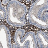 Anti-TRIOBP antibody produced in rabbit Prestige Antibodies&#174; Powered by Atlas Antibodies, affinity isolated antibody, buffered aqueous glycerol solution