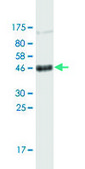 Monoclonal Anti-CD151 antibody produced in mouse clone 1B2, purified immunoglobulin, buffered aqueous solution