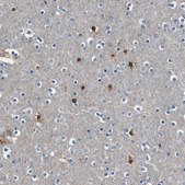 Anti-PRKCA antibody produced in rabbit Ab2, Prestige Antibodies&#174; Powered by Atlas Antibodies, affinity isolated antibody, buffered aqueous glycerol solution