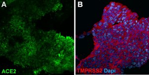 3dGRO&#174; Lung Organoid Maturation Medium Serum-free ready-to-use media used to differentiate lung bud organoids (LBOs) into mature branching lung organoids.