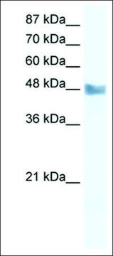 Anti-MAP3K8 antibody produced in rabbit IgG fraction of antiserum