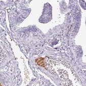 Monoclonal Anti-TTR antibody produced in mouse Prestige Antibodies&#174; Powered by Atlas Antibodies, clone CL0290, purified immunoglobulin, buffered aqueous glycerol solution