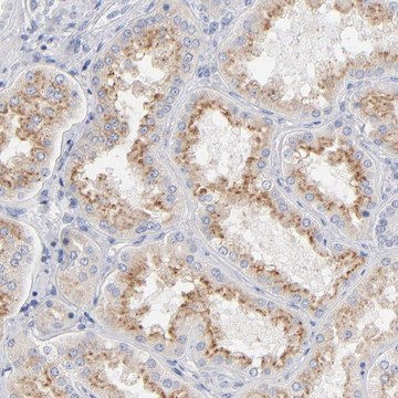 Anti-F12 antibody produced in rabbit Prestige Antibodies&#174; Powered by Atlas Antibodies, affinity isolated antibody, buffered aqueous glycerol solution