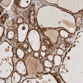 Anti-GCLM antibody produced in rabbit affinity isolated antibody, buffered aqueous glycerol solution