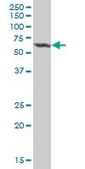 Anti-ALDH4A1 antibody produced in mouse purified immunoglobulin, buffered aqueous solution