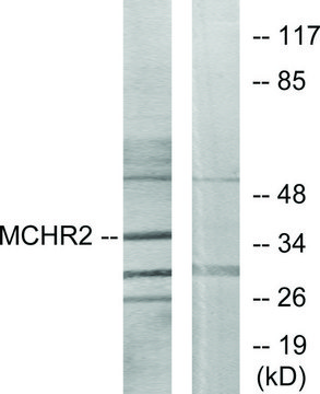 Anti-MCHR2 antibody produced in rabbit affinity isolated antibody