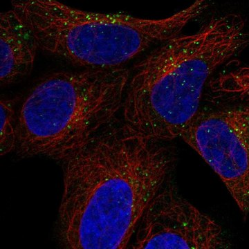 Anti-Snx27 Antibody Produced In Rabbit Prestige Antibodies&#174; Powered by Atlas Antibodies, affinity isolated antibody, buffered aqueous glycerol solution