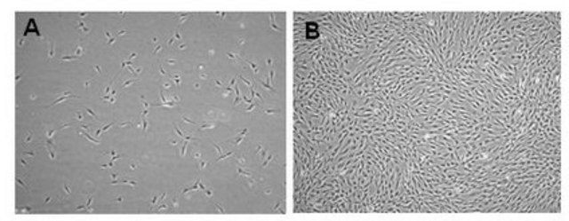 Human Adipose Mesenchymal Stem Cells Human Adipose Mesenchymal Stem Cells (MSCs) are isolated from human adipose tissue and are cryopreserved at P2 to ensure optimal phenotype and the highest viability and plating efficiency.