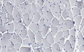 Anti-PKM1 Antibody, clone 1B15 ZooMAb&#174; Rabbit Monoclonal recombinant, expressed in HEK 293 cells