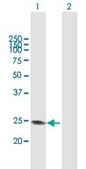 Anti-GAMT antibody produced in mouse purified immunoglobulin, buffered aqueous solution