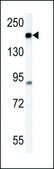 ANTI-ATP11C (CENTER) antibody produced in rabbit IgG fraction of antiserum, buffered aqueous solution