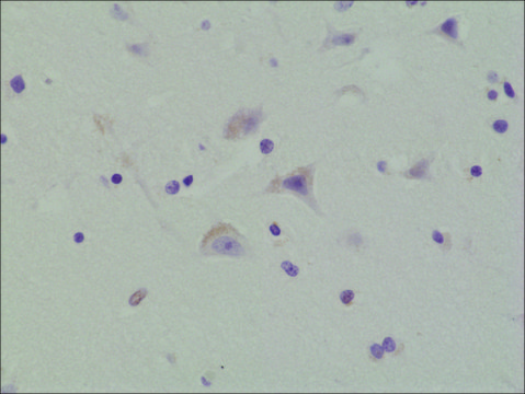 Anti-Phospho-AMPA Receptor antibody, GluR 1 subunit (Ser845), Rabbit Monoclonal recombinant, expressed in HEK 293 cells, clone RM296, purified immunoglobulin