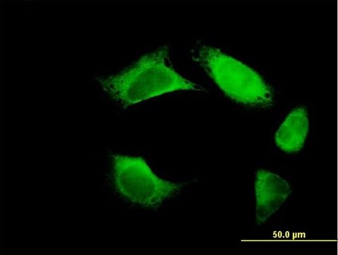 Anti-FERMT3 antibody produced in mouse IgG fraction of antiserum, buffered aqueous solution
