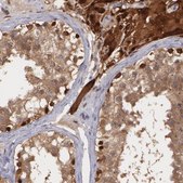 Anti-TXNRD1 antibody produced in rabbit Prestige Antibodies&#174; Powered by Atlas Antibodies, affinity isolated antibody, buffered aqueous glycerol solution