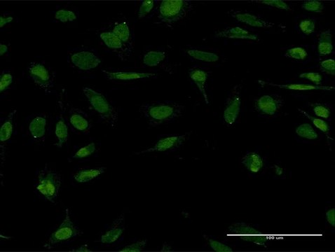 Monoclonal Anti-STC1, (C-terminal) antibody produced in mouse clone 1A3, purified immunoglobulin, buffered aqueous solution