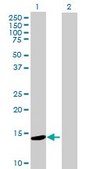 Anti-ZNF593 antibody produced in mouse IgG fraction of antiserum, buffered aqueous solution