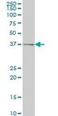 Monoclonal Anti-ADH6 antibody produced in mouse clone 4G4, purified immunoglobulin, buffered aqueous solution