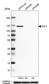 Anti-ACLY antibody produced in rabbit Prestige Antibodies&#174; Powered by Atlas Antibodies, affinity isolated antibody, buffered aqueous glycerol solution