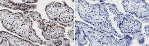Anti-MLL2 Antibody, clone 3L17 ZooMAb&#174; Rabbit Monoclonal recombinant, expressed in HEK 293 cells