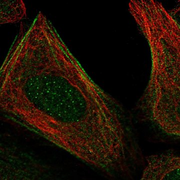 Anti-Elmod2 Antibody Produced In Rabbit Prestige Antibodies&#174; Powered by Atlas Antibodies, affinity isolated antibody, buffered aqueous glycerol solution