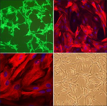 Rat Astrocytes: RA, neonatal