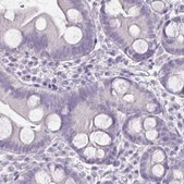 Monoclonal Anti-TG antibody produced in mouse Prestige Antibodies&#174; Powered by Atlas Antibodies, clone CL0164, purified immunoglobulin, buffered aqueous glycerol solution