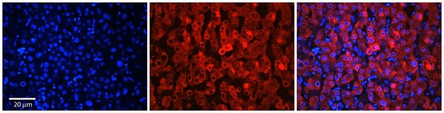 Anti-SLC37A4 antibody produced in rabbit affinity isolated antibody