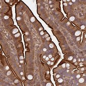 Anti-TNMD antibody produced in rabbit Prestige Antibodies&#174; Powered by Atlas Antibodies, affinity isolated antibody, buffered aqueous glycerol solution