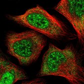 Anti-PCBP1 antibody produced in rabbit Prestige Antibodies&#174; Powered by Atlas Antibodies, affinity isolated antibody