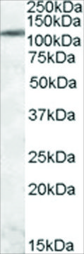 Anti-ERN1/IRE1A antibody produced in goat affinity isolated antibody, buffered aqueous solution