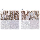 Anti-CDH17 antibody produced in rabbit Prestige Antibodies&#174; Powered by Atlas Antibodies, affinity isolated antibody, buffered aqueous glycerol solution, Ab3