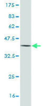 Monoclonal Anti-AADAC antibody produced in mouse clone 2E8, purified immunoglobulin, buffered aqueous solution