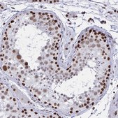 Anti-HNRNPDL antibody produced in rabbit Prestige Antibodies&#174; Powered by Atlas Antibodies, affinity isolated antibody, buffered aqueous glycerol solution