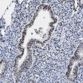 Anti-CBX2 antibody produced in rabbit Prestige Antibodies&#174; Powered by Atlas Antibodies, affinity isolated antibody, buffered aqueous glycerol solution