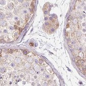 Anti-HIP1R antibody produced in rabbit Prestige Antibodies&#174; Powered by Atlas Antibodies, affinity isolated antibody, buffered aqueous glycerol solution