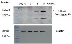 Anti-SIGLEC15 Antibody, clone 1B10 ZooMAb&#174; Rabbit Monoclonal recombinant, expressed in HEK 293 cells