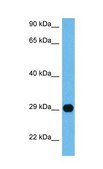 抗-IGFBP7 兔抗 affinity isolated antibody