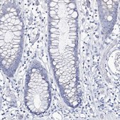Anti-CSN3 antibody produced in rabbit Prestige Antibodies&#174; Powered by Atlas Antibodies, affinity isolated antibody