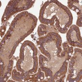 Anti-NT5DC2 antibody produced in rabbit Prestige Antibodies&#174; Powered by Atlas Antibodies, affinity isolated antibody, buffered aqueous glycerol solution