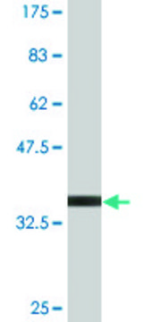 Monoclonal Anti-S100A11 antibody produced in mouse clone 1B12, purified immunoglobulin, buffered aqueous solution