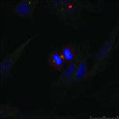 Anti-CTNNB1 (Ab-37) antibody produced in rabbit affinity isolated antibody