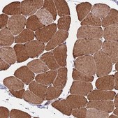 Anti-CDNF antibody produced in rabbit Prestige Antibodies&#174; Powered by Atlas Antibodies, affinity isolated antibody, buffered aqueous glycerol solution