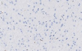 Anti-Tau-1 Antibody, clone PC1C6 ZooMAb&#174; Mouse Monoclonal recombinant, expressed in HEK 293 cells