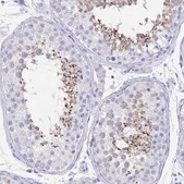 Anti-GPX4 antibody produced in rabbit Prestige Antibodies&#174; Powered by Atlas Antibodies, affinity isolated antibody