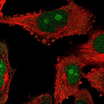 Anti-NOP14 antibody produced in rabbit Prestige Antibodies&#174; Powered by Atlas Antibodies, affinity isolated antibody