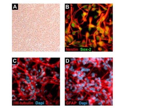 ReNcell CX Human Neural Progenitor Cell Line ReNcell CX is an immortalized human neural progenitor cell line with the ability to readily differentiate into neurons &amp; glial cells.