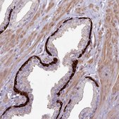 Anti-RAC1 antibody produced in rabbit Prestige Antibodies&#174; Powered by Atlas Antibodies, affinity isolated antibody, buffered aqueous glycerol solution