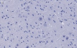 Anti-NMDAR2B Antibody, clone 5C18 ZooMAb&#174; Rabbit Monoclonal recombinant, expressed in HEK 293 cells
