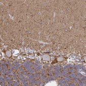 Anti-ATP1A3 antibody produced in rabbit Prestige Antibodies&#174; Powered by Atlas Antibodies, affinity isolated antibody, buffered aqueous glycerol solution