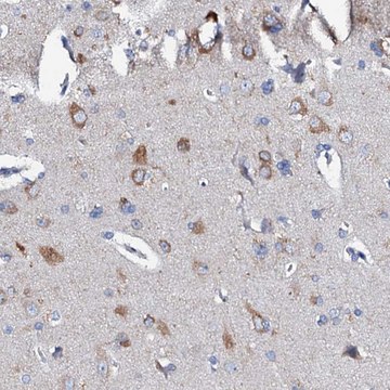 Anti-GLB1L3 antibody produced in rabbit Prestige Antibodies&#174; Powered by Atlas Antibodies, affinity isolated antibody, buffered aqueous glycerol solution